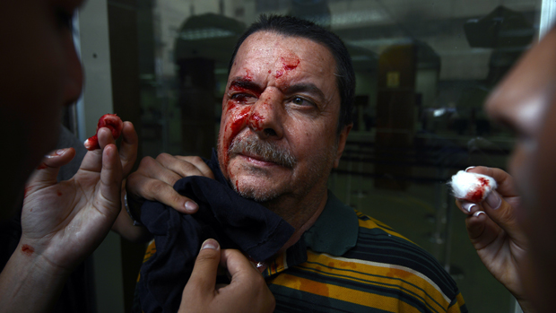 Homem é socorrido em manifestação contra o governo da Venezuela