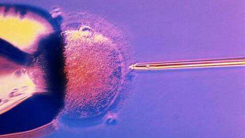 Reprodução assistida: as taxas de sucesso do procedimento estão em cerca de 30% por embrião transferido