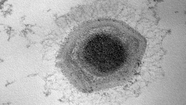 Vírus Samba: 11 000 bases de DNA e 600 nanômetros de tamanho