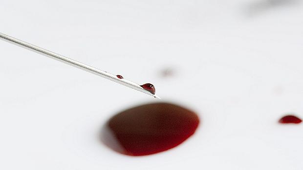Sangue