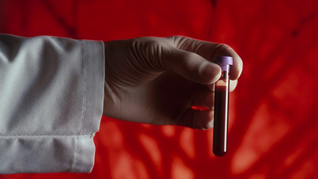 O novo exame de sangue poderá se tornar um procedimento corriqueiro no futuro