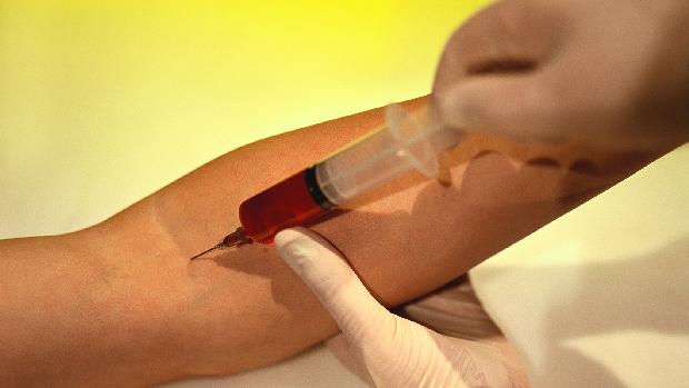Prevenção: um exame simples de sangue pode passar a ser uma forma segura de diagnóstico precoce do diabetes