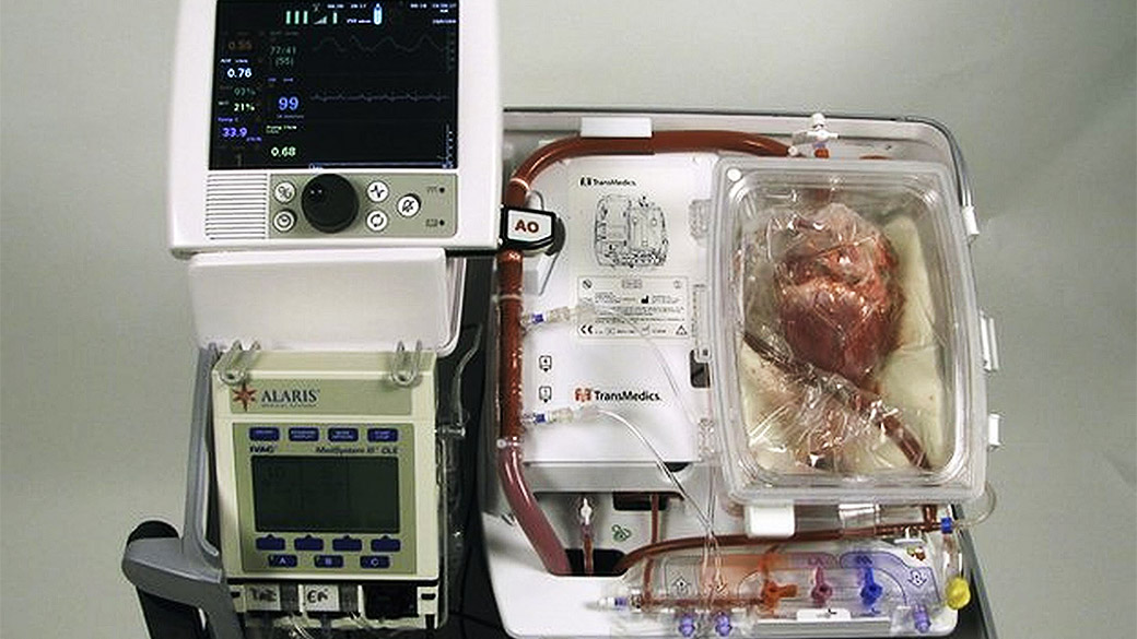 A máquina onde coração que deixou de bater é reanimado, tornando possível o seu transplante