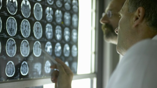 Atividade do cérebro visualizada por imagens de ressonância magnética funcional pode revelar o que a pessoa está planejando