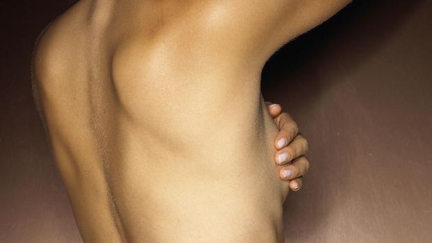 Mulheres que preservam a mama têm sobrevida semelhante às que fazem mastectomia