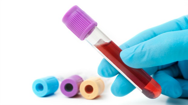Atualmente o diagnóstico clínico de infecções causadas por vírus e bactérias é impreciso e os exames laboratoriais são demorados, levando ao mal uso de antibióticos