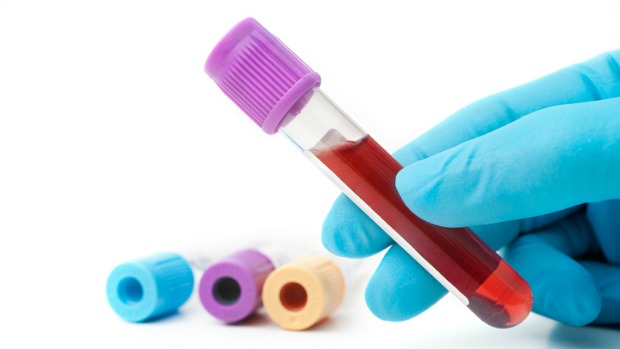 Exame admissional: CFM orienta médicos a não solicitarem testes de sangue e de urina para drogas ilícitas