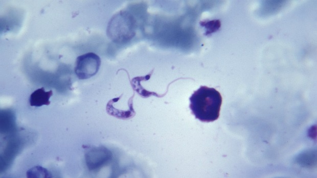 Trypanosoma cruzi, protozoário causador da doença de Chagas