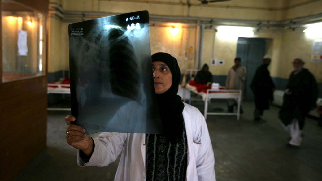 Médica examina radiografia pulmonar em hospital na cidade de Caxemira, Índia