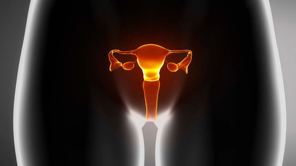Utero Endometriose