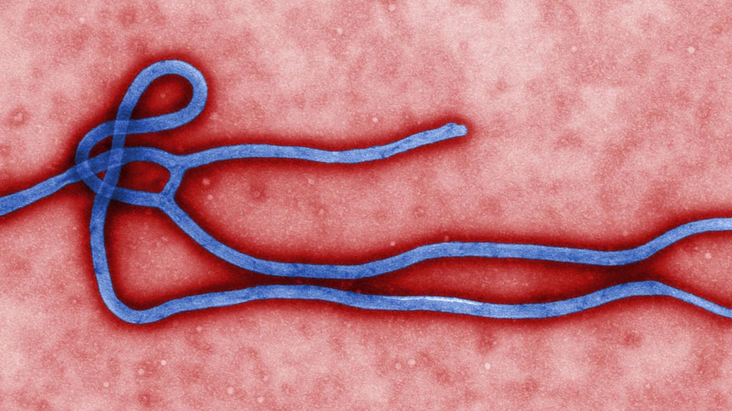 Vírus causador da ebola