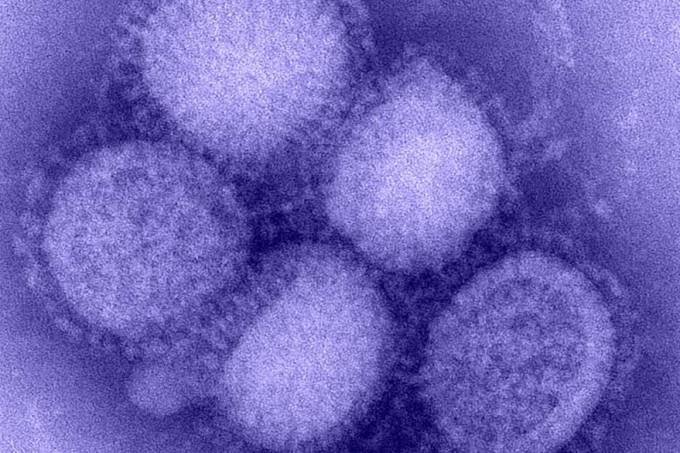 virus-h1n1-influenza-original.jpeg