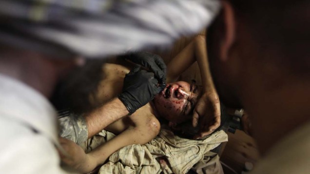 Menino afegão atingido acidentalmente por bomba caseira é atendido por médicos do exército americano