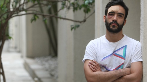 O estudante de Direito André Baliera, após agressão em rua movimentada de São Paulo