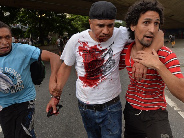 Homem ferido no rosto durante protestos em São Paulo