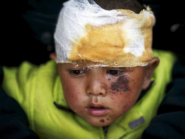 Abhishek Tamang, sobrevivente de apenas 4 anos, recebe atendimento médico em Dhading Besi, Nepal  - 27/04/2015