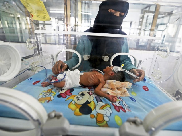 Médica atende um bebê recém-nascido em um hospital de Sanaa, no Iêmen. A escassez de combustível tem causado falta de abastecimento de alimentos no país - 07/05/2015