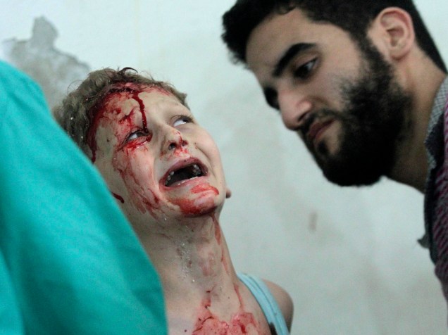 Em julho, garoto foi socorrido após ataque aéreo de forças leais ao ditador sírio Bashar Assad