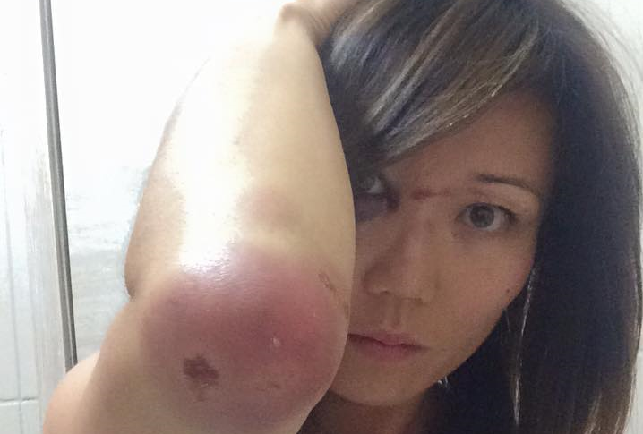 Turista japonesa teve ferimentos no braço e no rosto