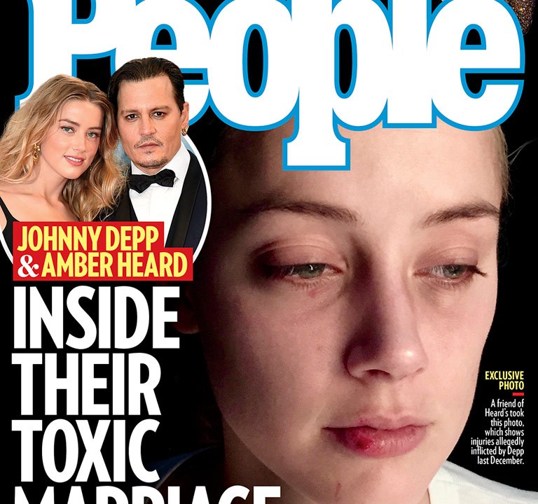 Capa da revista 'People' desta semana traz foto em que Amber Heard aparece com o rosto machucado