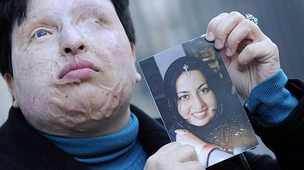 A iraniana Ameneh Bahrami, que atualmente reside na Espanha, mostra foto sua de antes de ser desfigurada