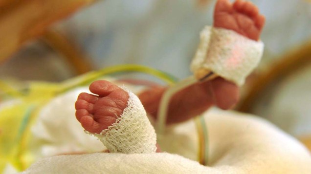 Bebê nascida prematura em incubadora do hospital universitário de Leipzig, Alemanha