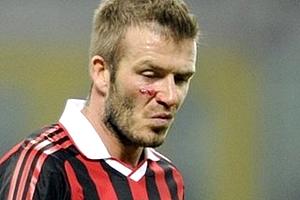 No Milan, Beckham rompeu o tendão de Aquiles