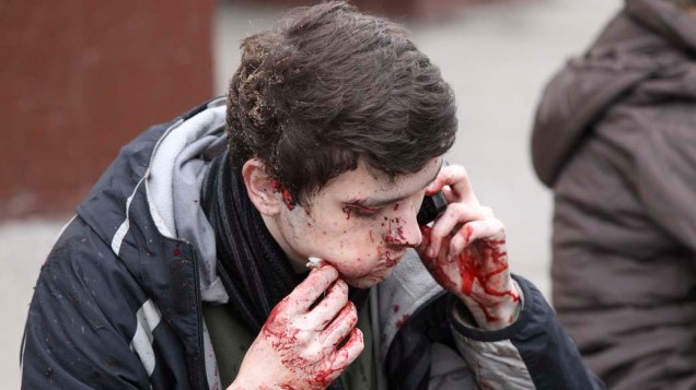 Sobrevivente do ataque terrorista que ocorreu no metrô de Moscou no dia 29 de março. A explosão causada por duas mulheres-bomba matou pelo menos 38 pessoas