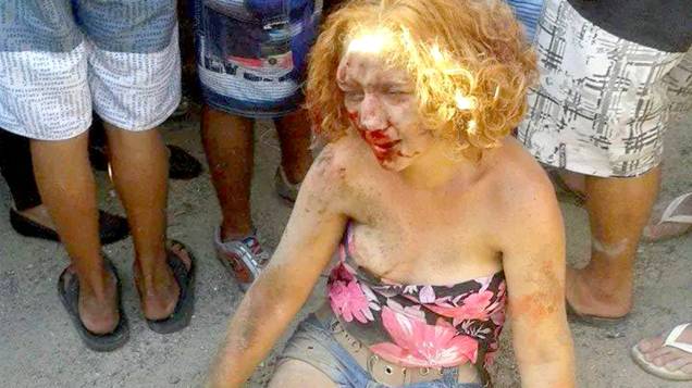 Foto mostra Fabiane Maria de Jesus após ser espancada Foto mostra Fabiane Maria de Jesus após ser espancada