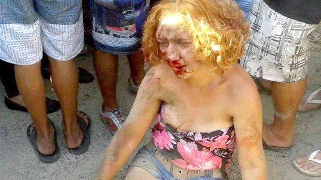 Foto mostra Fabiane Maria de Jesus após ser espancada