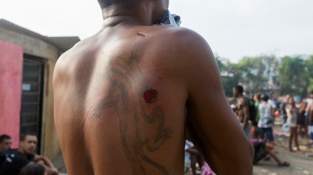 Homem ferido durante reintegração de posse do terreno da empresa de telefonia Oi, situado no Engenho Novo, Zona Norte do Rio