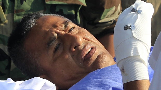 O 'camarada Artemio', ex-líder do Sendero Luminoso, passou por operação após ser capturado no Peru