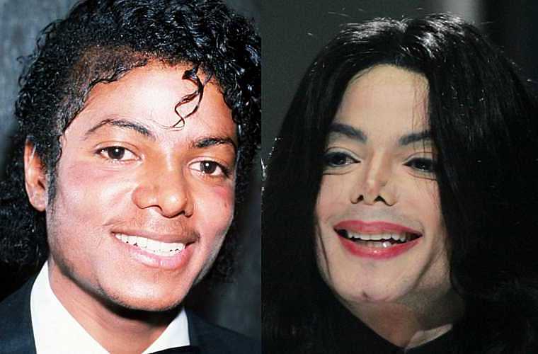 Não se sabe quantas cirurgias plásticas o astro recém-morto Michael Jackson realizou - quase não lembra o rosto que tinha alguns anos antes.