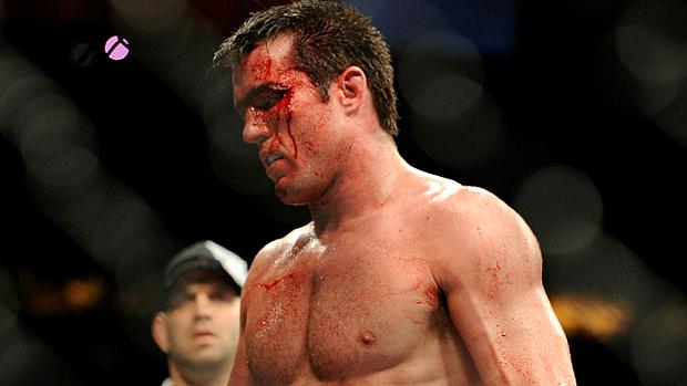 Chael Sonnen foi finalizado por Anderson Silva no UFC 119, em 2010