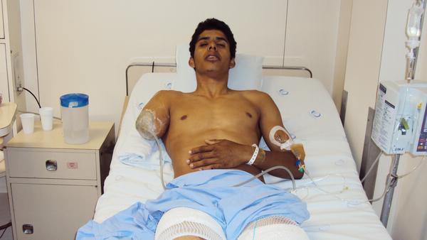 Ciclista David Santos Sousa teve o braço amputado em um acidente de trânsito em São Paulo