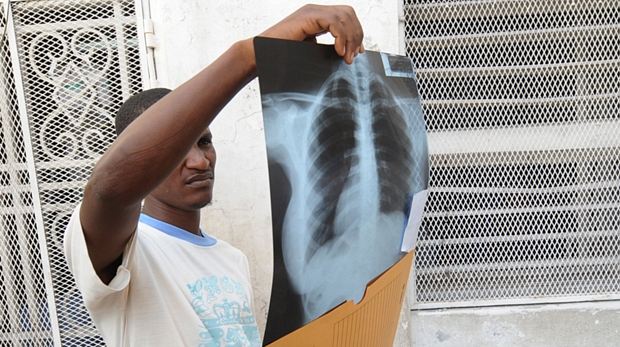 Parente de vítima da cólera avalia radiografia no Hôpital de l’Université d’Etat, em Porto Príncipe
