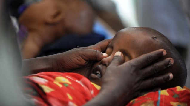 Criança morre de desnutrição em hospital na cidade de Mogadíscio, Somália