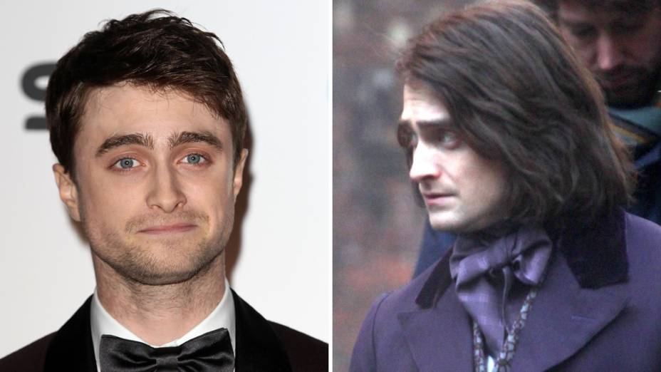 Daniel Radcliffe com aplique no cabelo para seu novo papel no filme Frankstein