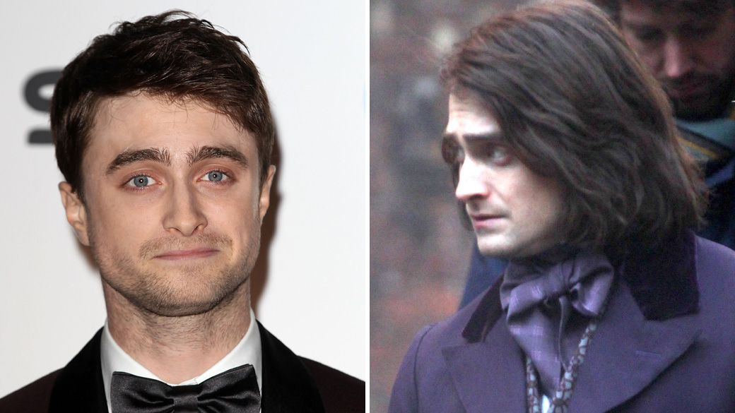 Daniel Radcliffe com aplique no cabelo para seu novo papel no filme 'Frankstein'