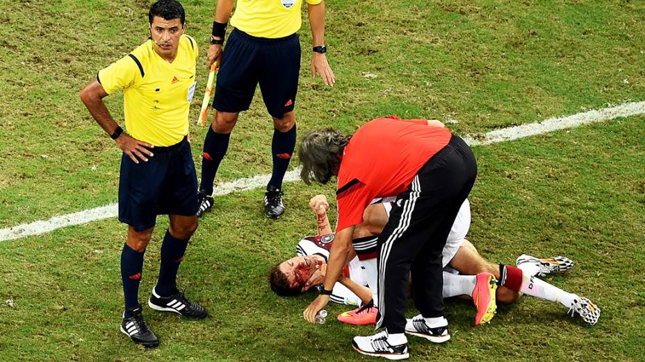 O alemão Thomas Müeller sangra após bater cabeça com o ganês John Boye