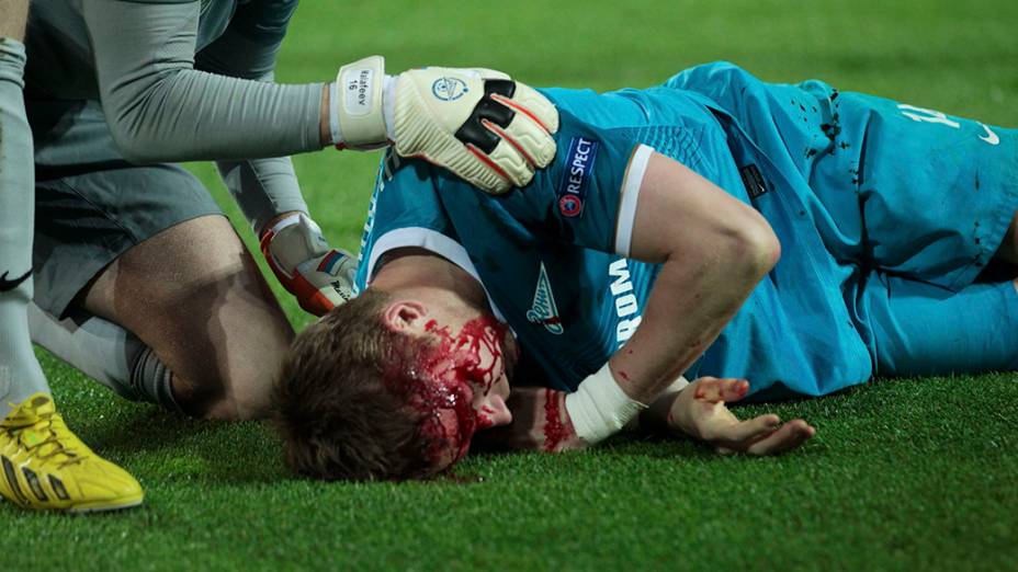 Hubocan, do Zenit, recebeu uma joelhada acidental de Lewandowski e teve de deixar o campo mais cedo