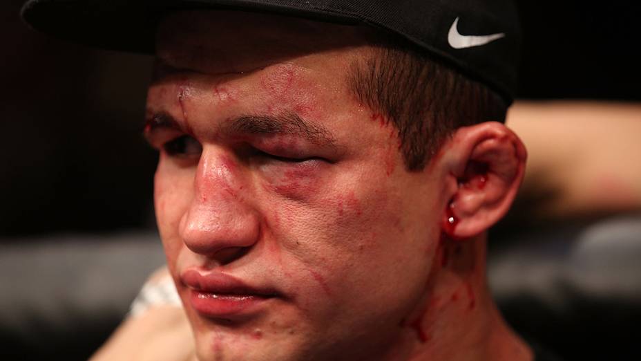 UFC 166: Júnior Cigano após ser derrotado por Cain Velasquez