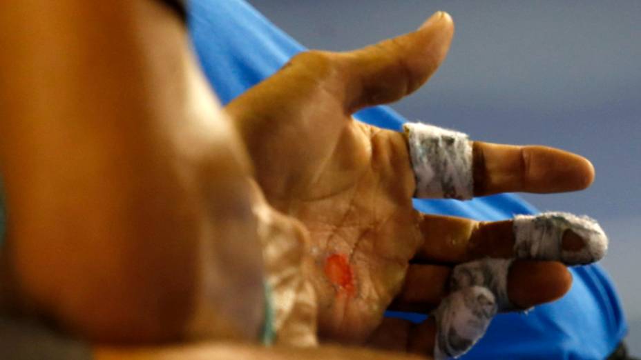 Mão machucada de Rafal Nadal na partida conta o suíço Roger Federer