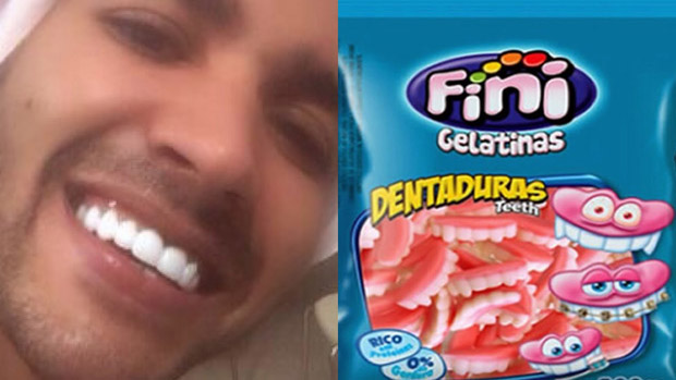 Os novos dentes de Gusttavo Lima poderiam ser dentaduras de gelatina