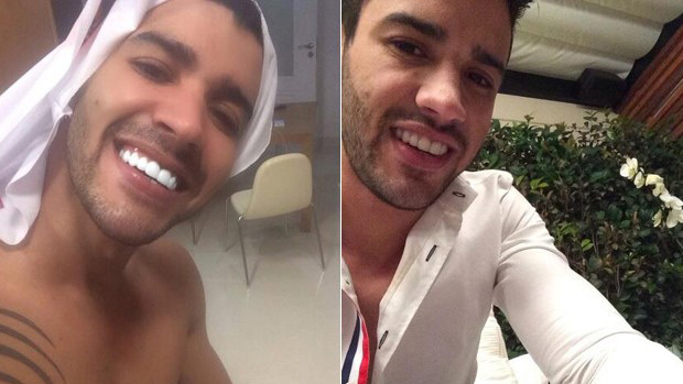 Gusttavo Lima antes e depois do clareamento dental