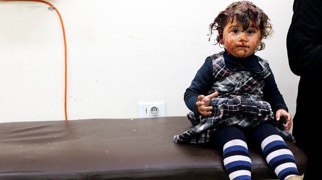 Menina foi ferida durante ataque aéreo do governo na cidade de Aleppo, ao norte da Síria