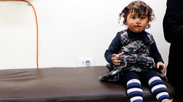 Menina foi ferida durante ataque aéreo do governo na cidade de Aleppo, ao norte da Síria Menina foi ferida durante ataque aéreo do governo na cidade de Aleppo, ao norte da Síria