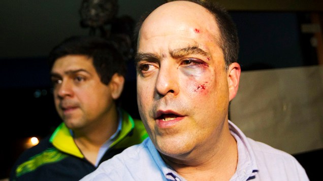 O deputado venezuelano Julio Borges, do bloco de oposição ao chavismo, mostra ferimentos após agressão na Assembleia Nacional