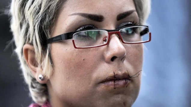 Iraniana costura a boca em greve de fome na Grécia em protesto contra a demora na autorização de asilo político