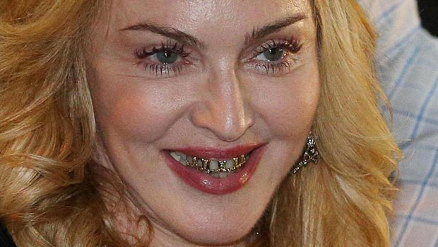 Madonna se torna adepta da moda grillz